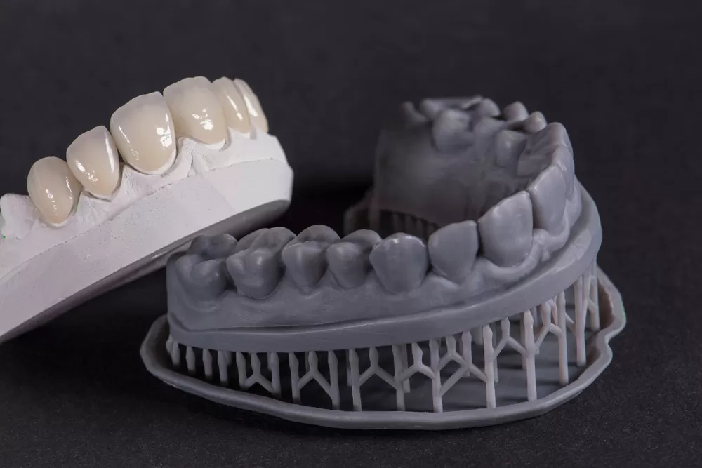 3d Dental Prothesen Produktion