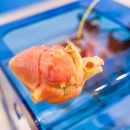 3d Druck Medizinisch 2