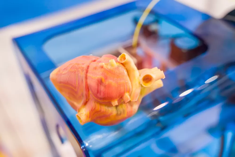 3d Druck Medizinisch 2