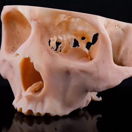 3d Drucker Gesundheitssektor 1