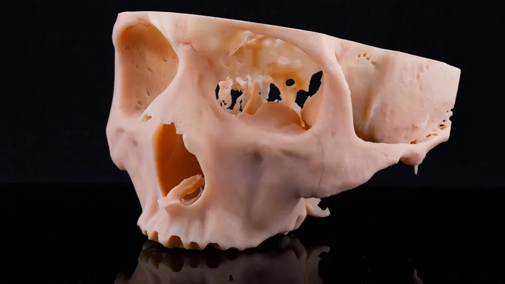 3d Drucker Gesundheitssektor 1