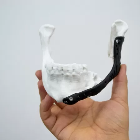 Biomedizinische 3d Produktion Preise