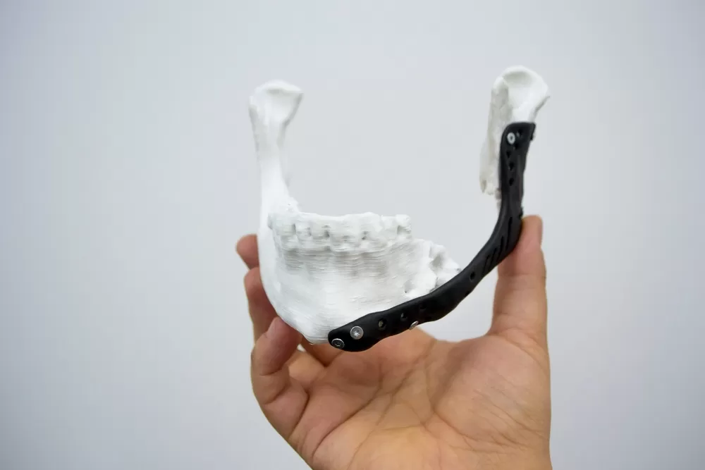 Biomedizinische 3d Produktion Preise