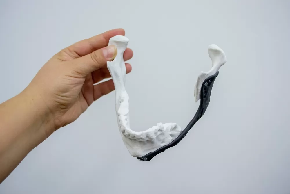 Medizinische 3d Modelle 1