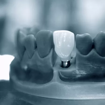 Medizinische 3d Modelle