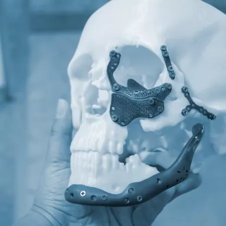 Zahnmedizinische 3d Produktion 1