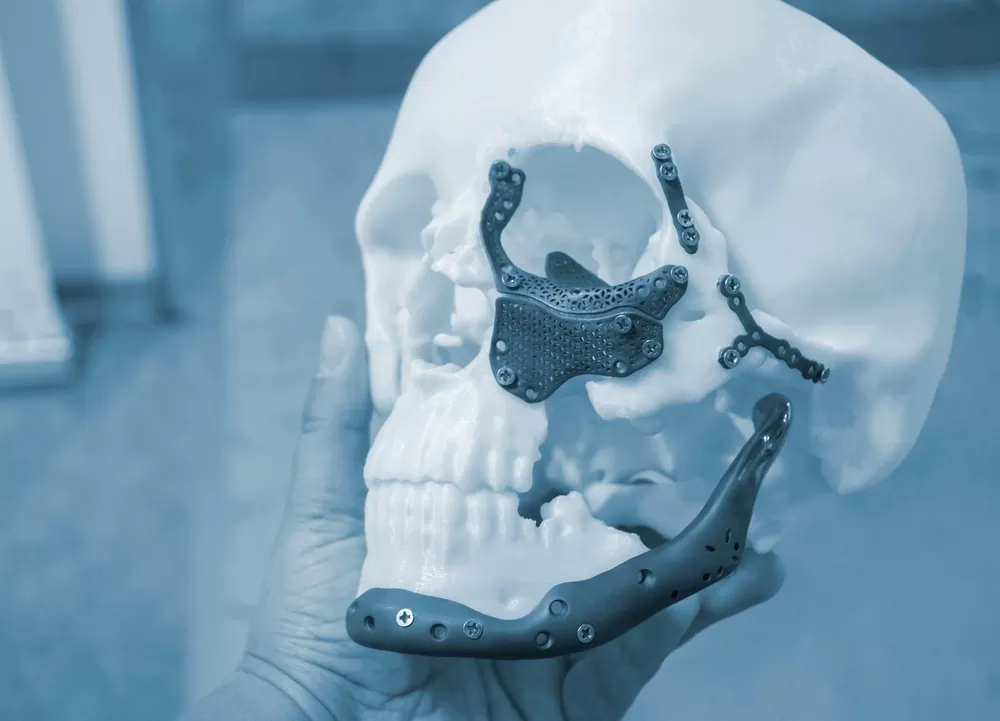 Zahnmedizinische 3d Produktion 1